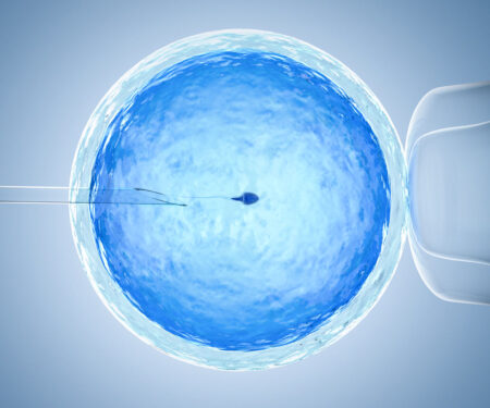 ICSI treatment at Surrey Park Women's Clinic