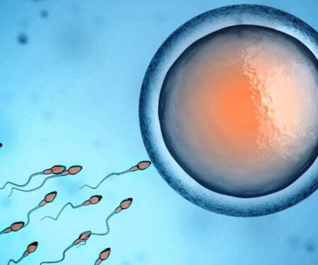 IVF treatment